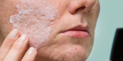 tratamento de acne